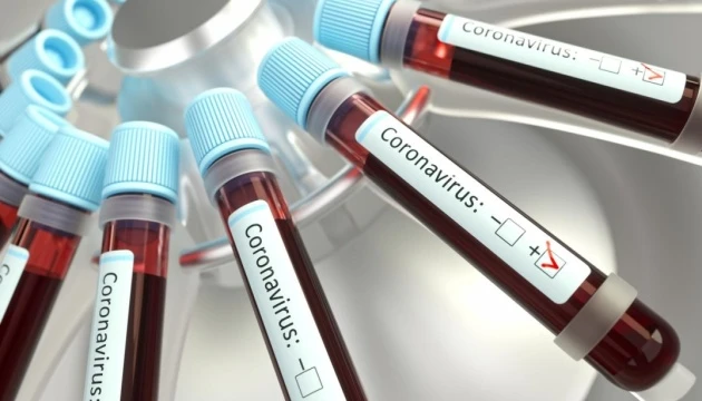 У Сокалі на Львівщині керівництво ДВК захворіло на COVID-19