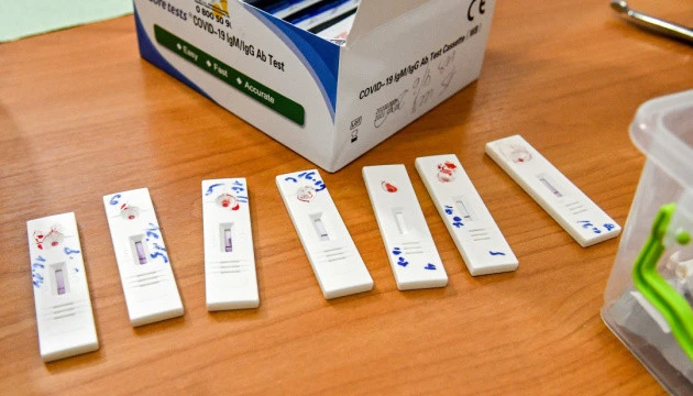 На Буковині нарахували вже понад 5 тисяч випадків COVID-19