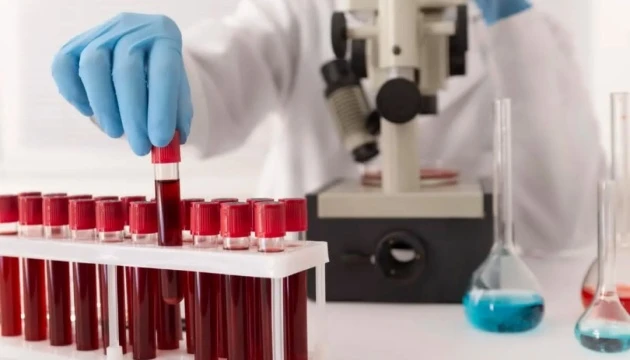 У Нідерландах медпрацівник отримав один позитивний тест на хантавірус