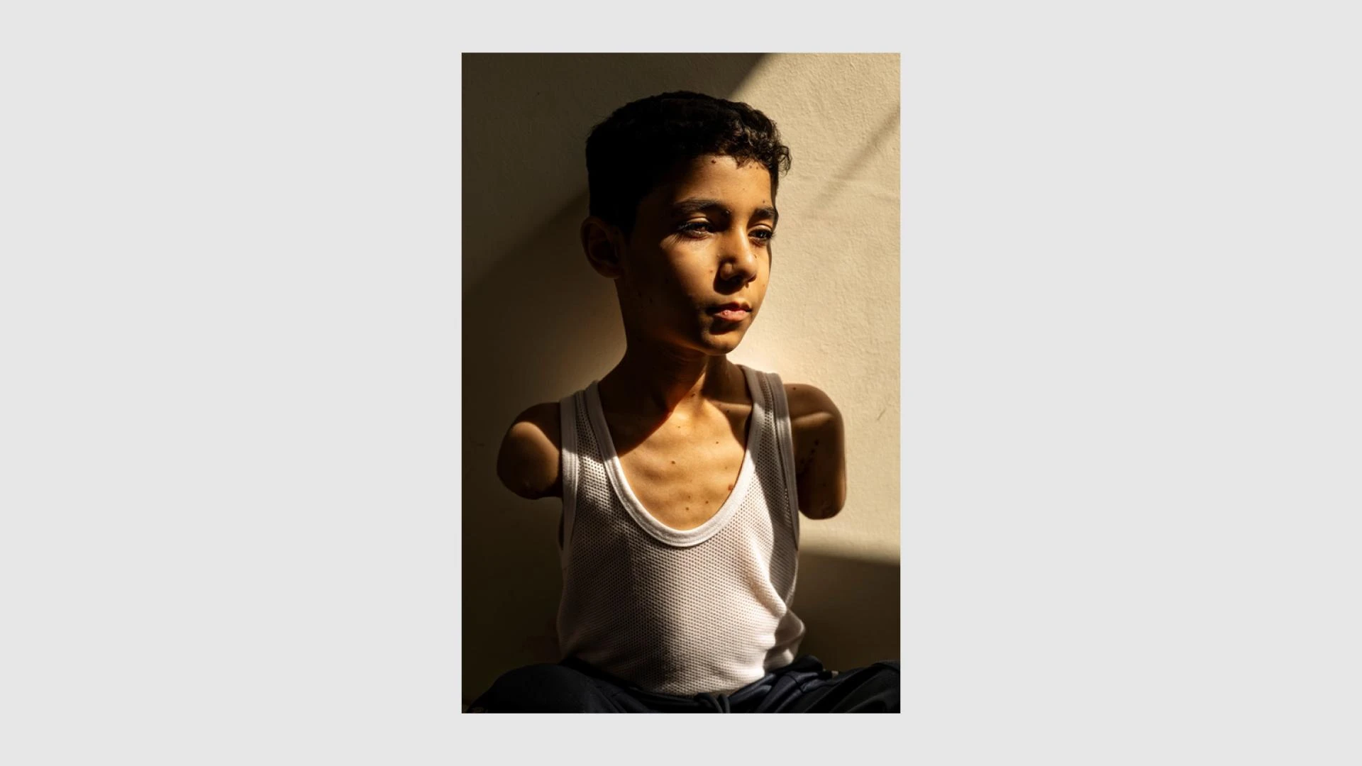 La foto che ha vinto il World Press Photo 2025 racconta la storia di migliaia di altri bambini di Gaza