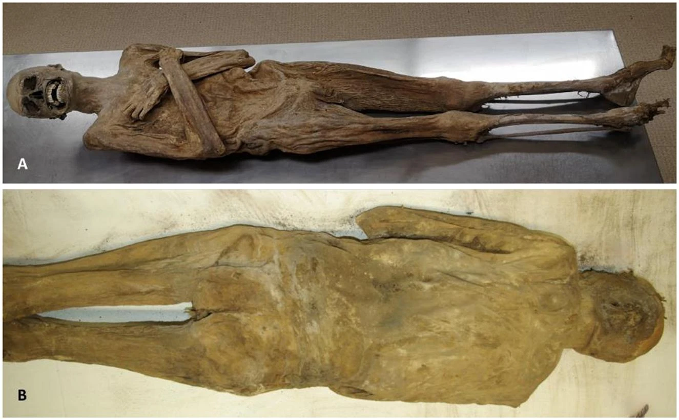 Svelato l’enigma della mummia austriaca. “Il cappellano è stato imbalsamato attraverso il retto”