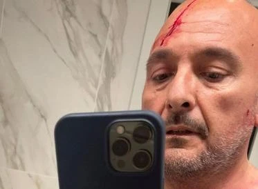 Caso Sangiuliano-Boccia, il giallo del tentato omicidio