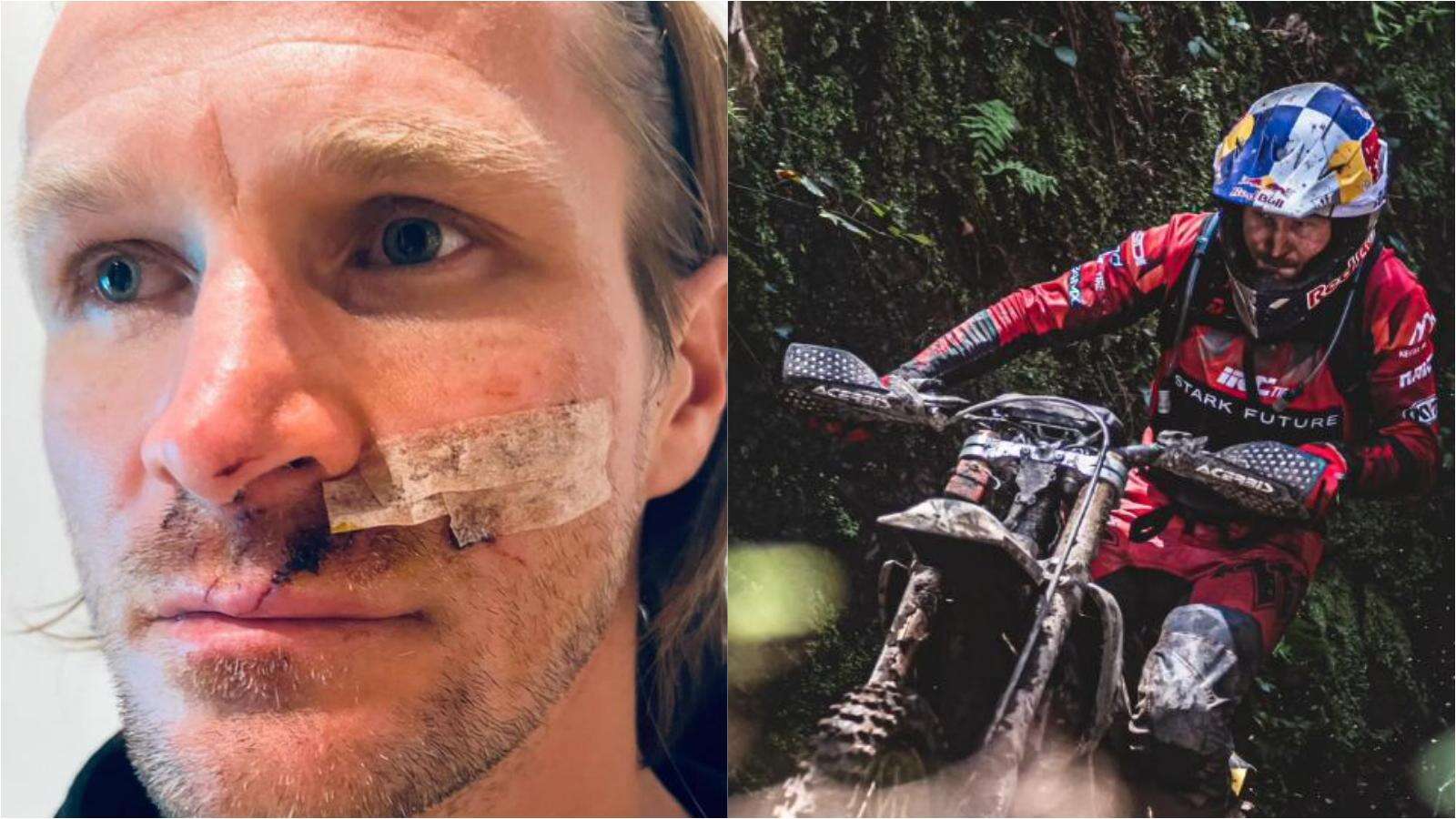 Tadeus Blazusiak sfregiato da un cavo d’acciaio: salvo per miracolo l’asso del motocross