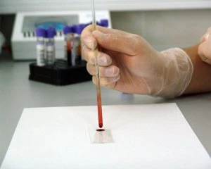 Учені здійснили прорив у діагностуванні раку