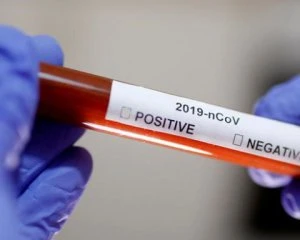 Johnson & Johnson відновить випробування вакцини проти Covid-19