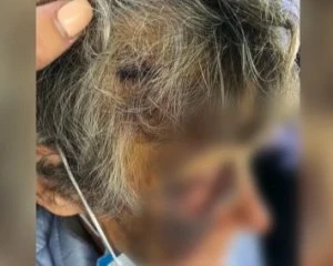 Били і тримали в жахливих умовах: у приватному пансіонаті знущалися з літніх людей