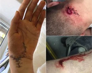 Стерненко заявив, що третій напад проти нього не розслідують