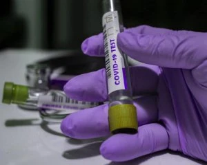 Врятував карантин: від коронавірусу в Україні могли померти 120 тис. людей
