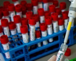 На боротьбу з Covid-19 виділять 2 млрд гривень