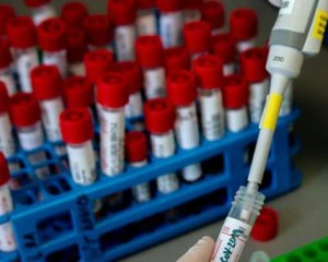 В Одесі відкривають додатковий госпіталь для інфікованих Covid-19