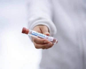 Коронавірус в Україні: які області відзначилися найгіршими показниками