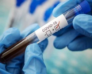 Зафіксували першу смерть від коронавірусу 