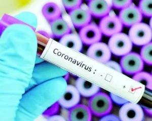 Результатів не дочекаються: лабораторія анулювала 1500 тестів на Covid-19