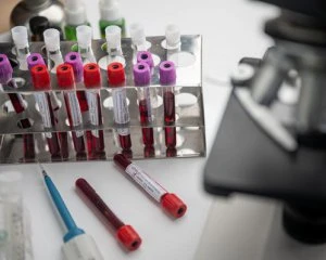 Польща оплатить тестування на коронавірус українським заробітчанам