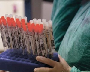 Знову стрибок за кількістю заражень та смертей: яка ситуація з коронавірусом в Україні