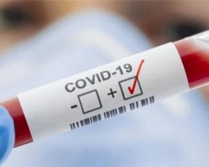Італійська компанія створила  найшвидший тест на  Covid-19