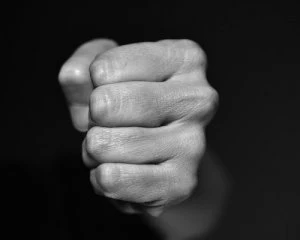 Травма голови і пошкоджене авто: на Вінничині побилися кандидати в депутати