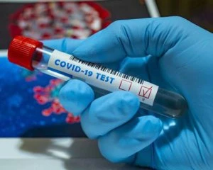 90 миротворців ООН заразилися коронавірусом