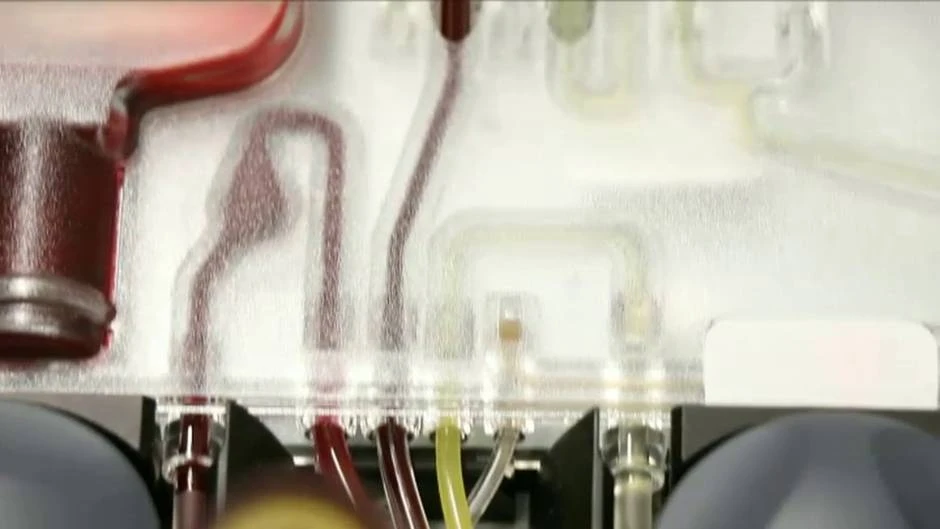 Nobel de medicina para los descubridores del virus de la hepatitis C