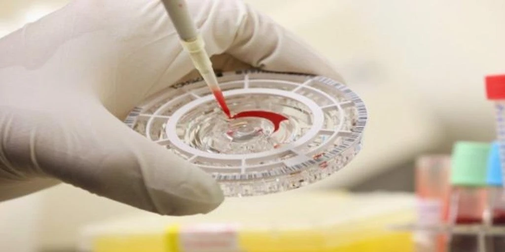 Chapare, el virus similar al ébola que se transmite entre personas