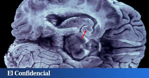 Estudian el cerebro y encuentran la explicación a por qué las mujeres viven más (y mejor)