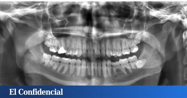 Estudian la mandíbula humana y descubren por qué no deberías saltarte ni una sola revisión del dentista