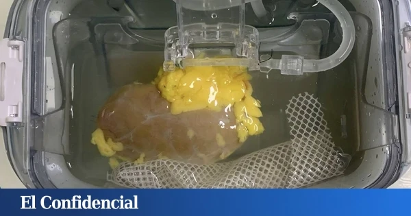 Hacen un experimento con un riñón humano y logran que sea compatible de forma universal