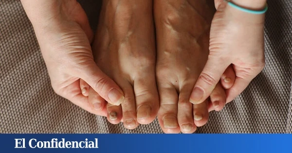 ¿Cómo eliminar hongos de las uñas de los pies rápidamente?