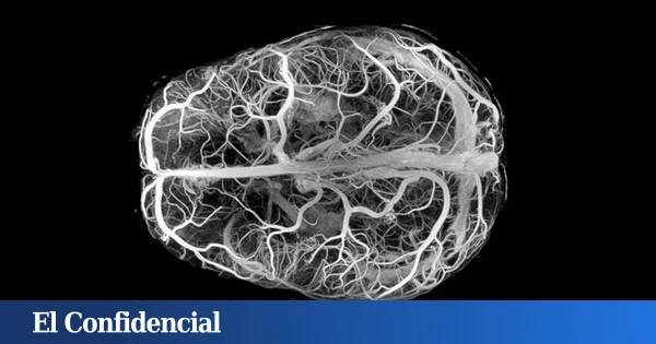 Hacen un experimento con cerebros humanos y descubren que 'leer la mente' es perfectamente posible
