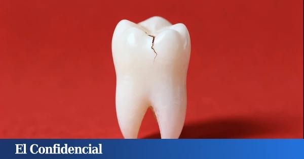 Inventan un gel que repara los dientes dañados por la edad en solo días