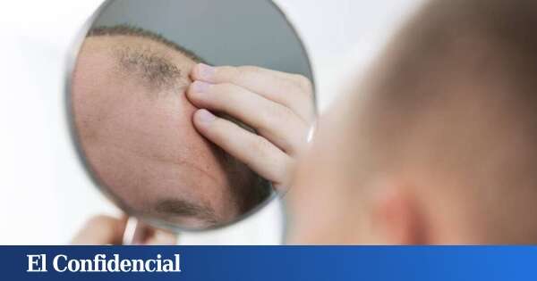 ¿Adiós a la calvicie? La ciencia descubre cómo revertir el proceso y recuperar el pelo perdido