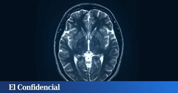 Descubren que nuestro cerebro es extremadamente lento procesando pensamientos