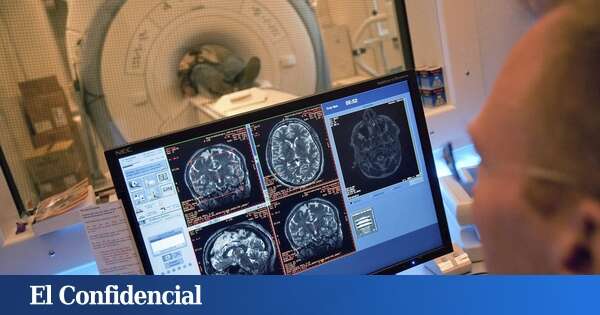 Descubren que cerebro ha aumentando drásticamente de tamaño en las últimas décadas