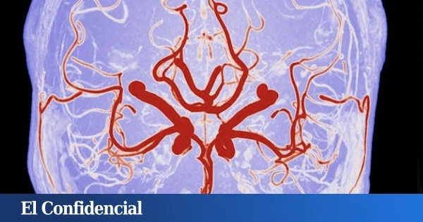 Estudian el cerebro humano y encuentran un circuito oculto que vigila cada uno de tus pasos en tiempo real