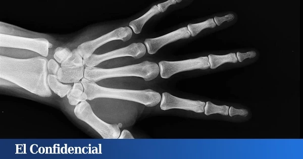 Reino Unido extrae queratina de lana de oveja y fabrica un nuevo material que regenera dientes y huesos