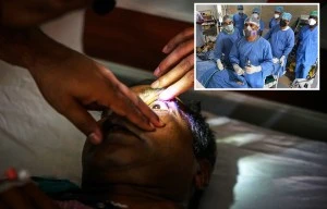 Docs REMOVE kid’s eyes to stop black fungus from Delta variant killing them