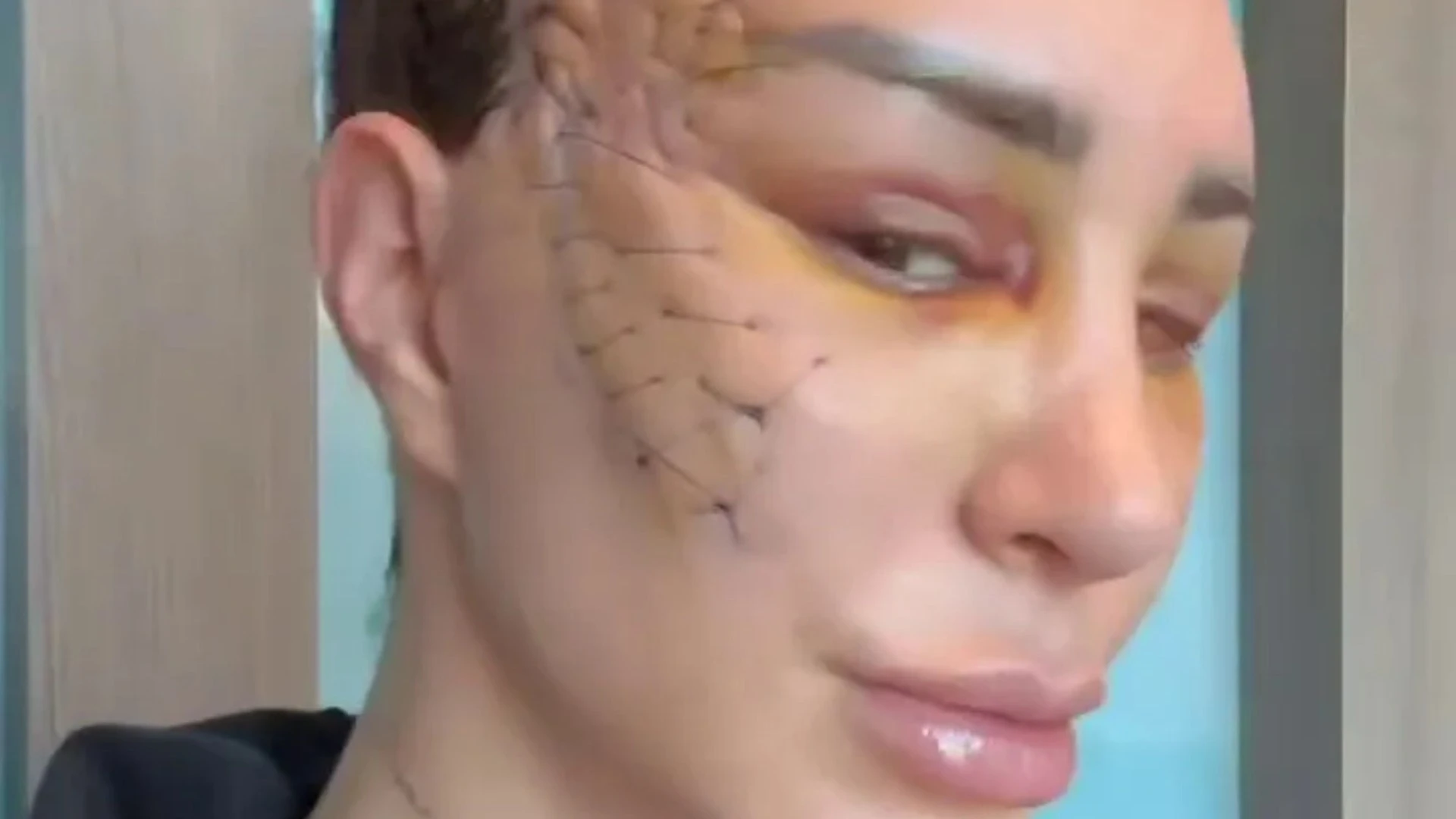 Reality star leaves fans horrified as she reveals result of extreme surgery and they beg her ‘get therapy’