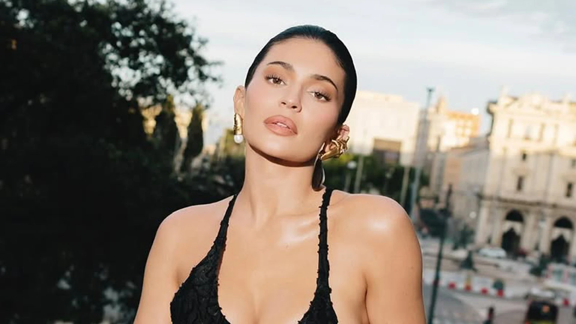Kylie Jenner ‘got a nose job, chin and jaw remodeling, fillers and fat transfers’ in addition to boob job, experts say