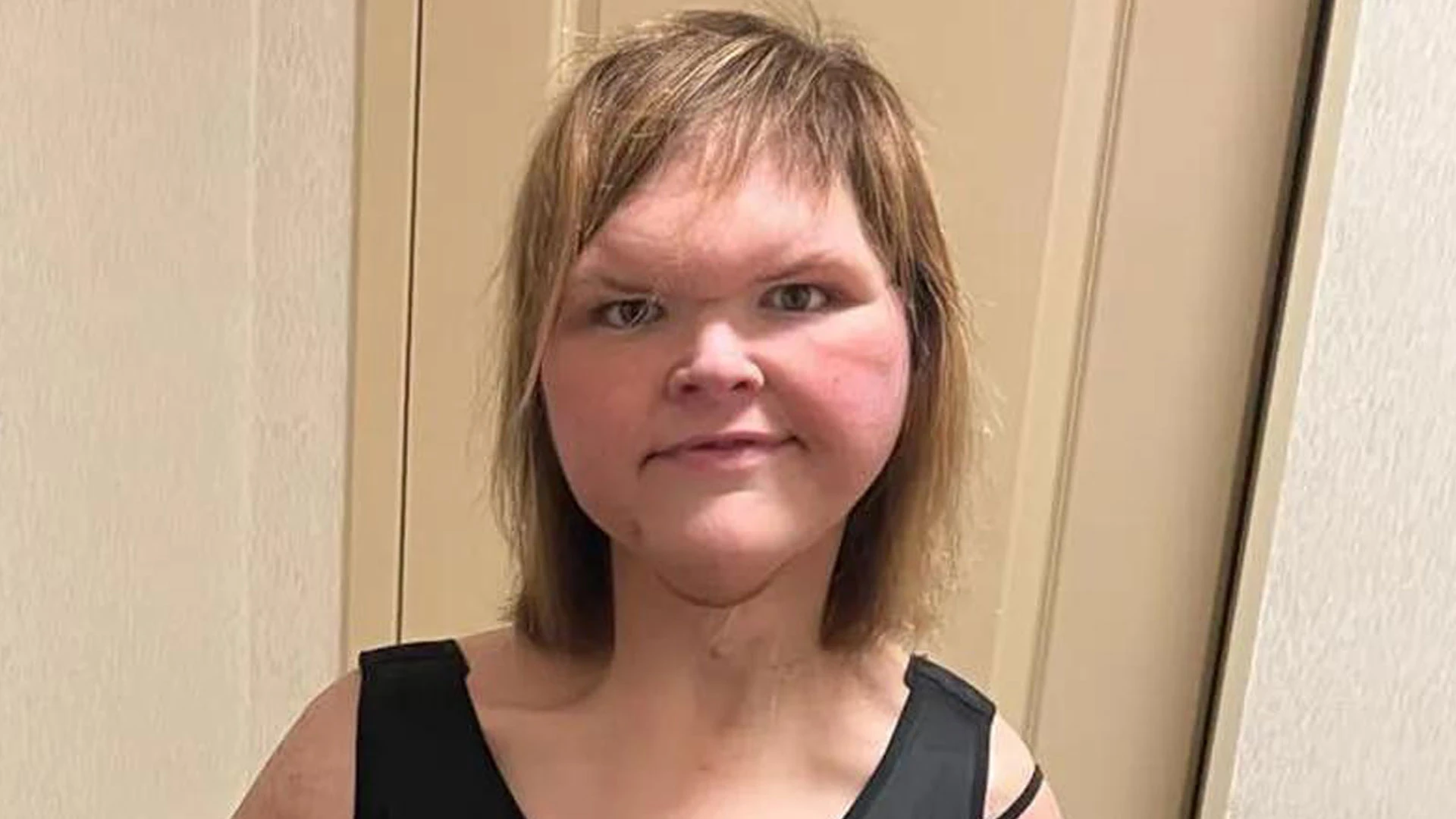 1000-Lb. Sisters’ Tammy Slaton debuts new cosmetic procedure on video interview and admits ‘I’m still getting more done’