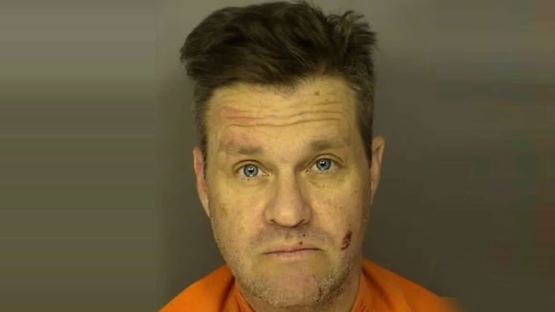 Home Improvement’s Zachery Ty Bryan seen bruised & cut up in mug shot as he’s arrested again months after felony charge