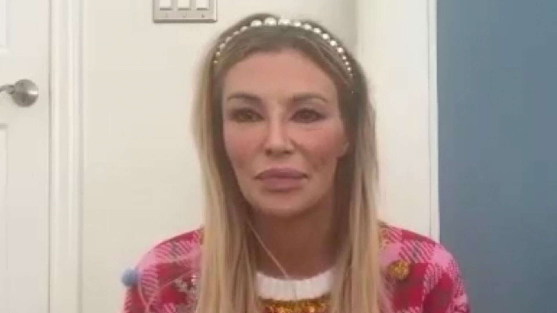 Brandi Glanville loses 5 teeth from stress, infection and swelling disease- but she’s ‘determined to get her smile back’