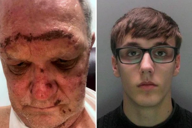 Road rage driver, 19, jailed after leaving elderly man with fractured jaw