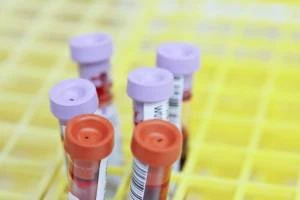 Un organo invecchia prima. E il sangue ci rivela qual è