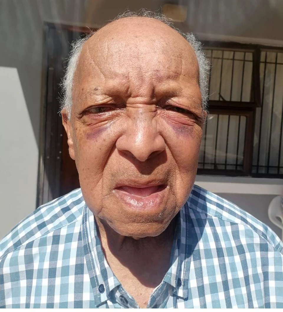 Afgetrede dominee (84) pimpel en pers geslaan in huisroof