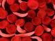 Nigeria Has Highest Prevalent Rate of Sickle Cell Worldwide, Says FG
