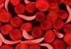 Abia Intensities Fight against Sickle Cell Disease, Integrates Study into School...