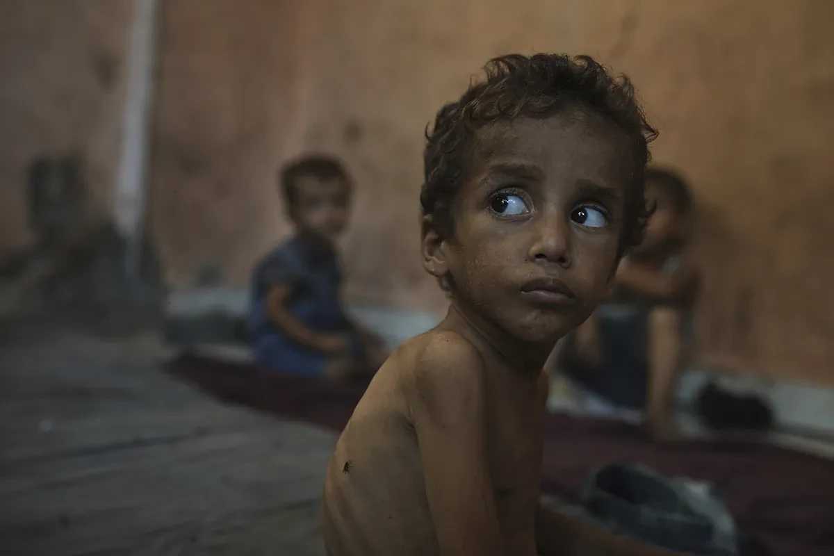 La hambruna provocada por el bloqueo israelí condena a Gaza a otra batalla contrarreloj, ésta para salvar vidas: 