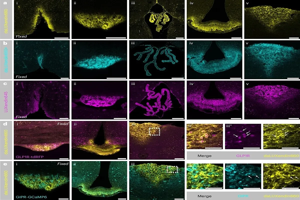 Una técnica fluorescente permite ver por primera vez cómo Mounjaro actúa en el cerebro y controla el apetito