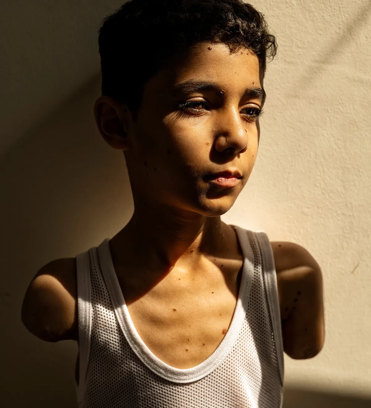 La imagen de un niño amputado tras un ataque israelí, uno más de tantos, ganadora del World Press Photo