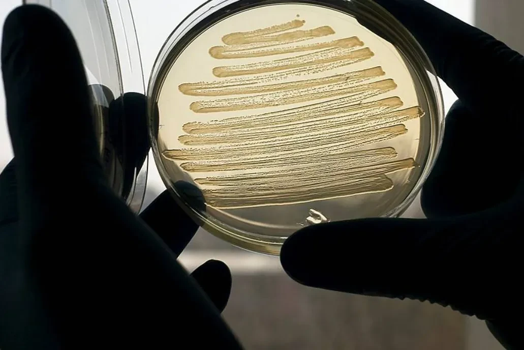 Científicos detectan la rápida propagación de un gen que desafía los tratamientos antimicrobianos